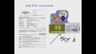 FALL RISK ASSESSMENT FOR OSCE [upl. by Reteip]