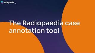 Annotating Radiopaedia cases [upl. by Aicerg]