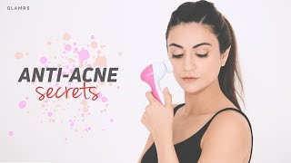 How To Combat Pimples And Acne  Affordable And Effective Remedies [upl. by Karlik691]