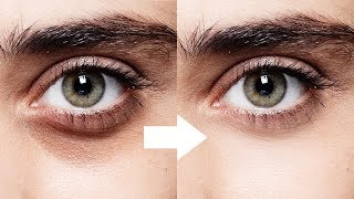 1Minute Photoshop  Remove Dark Circles Naturally [upl. by Seve874]