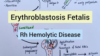 Hemolytic Disease of Fetus amp Newborn [upl. by Elocan]