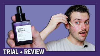 some by mi retinol intensive reactivating serum  trial  review [upl. by Mathias]