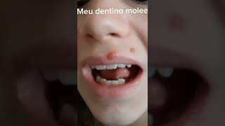 Meu dente mole [upl. by Teriann]