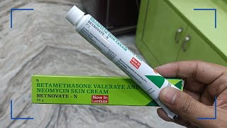 Betamethasone Valerate and Neomycin Skin Cream Uses In Hindi  Betnovate N Cream In Hindi [upl. by Donatelli261]