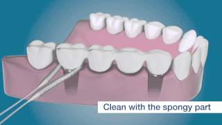 Clean around your dental implants with TePe Bridge amp Implant Floss [upl. by Zsa Zsa]