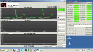 ECG Analysis Desktop Application [upl. by Tenner]