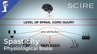 Spasticity and Spinal Cord Injury Physiological Basis [upl. by Bostow]