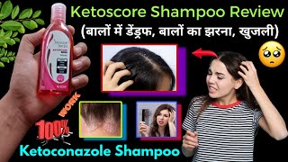 Ketoscore shampoo uses in hindi  Ketoconazole shampoo  Ketoscore shampoo review  Ketoscore [upl. by Nilyam]