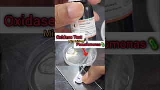 Oxidase Test 🧫🧪🔬🦠 Biochemicaltest  Microbiology Lab  Basics biochemistry shorts microbiology [upl. by Walley]