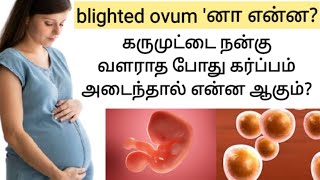 blighted ovum pregnancy in tamil  anembryonic pregnancy tamil  positive pregnancy test but no baby [upl. by Camile]