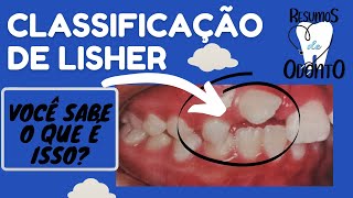 Classificação de Lisher  Resumos de Odonto [upl. by Laved]