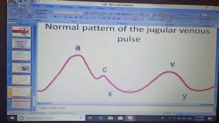 CVS Examination New System Jugular Venous Pulse Power point Dr Mohamed Fayez [upl. by Pulcheria]