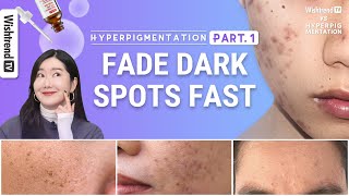 How to Get Rid of Hyperpigmentation Brightening Skincare Routine  Fade Face Dark Spots Fast part1 [upl. by Caterina]