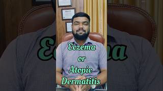 Say Goodbye to eczema with gentle effective homeopathic solutions  Dr RaviEczemaRelief eczema [upl. by Irami]