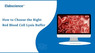 How to Choose the Right Red Blood Cell Lysis Buffer [upl. by Sacken]