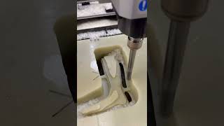 Prosthetics made with ShopBot MAX ATC carving wax positive for lost wax casting cnc prosthetics [upl. by Aita]