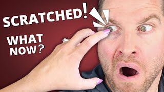 Scratched Eye  What You NEED To Know  Corneal Abrasion Symptoms Treatment [upl. by Hatnamas]