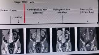 CT SCAN INTERVIEW WITH NCCT KUB CECT KUB UROGRAPHY [upl. by Finkelstein]