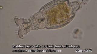 Rotifers under the microscope [upl. by Tews]