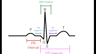 EKGECG Interpretation Basic  Easy and Simple [upl. by Aiykan]