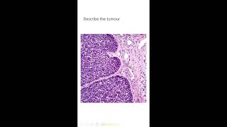 epithelial lesions [upl. by Rich]