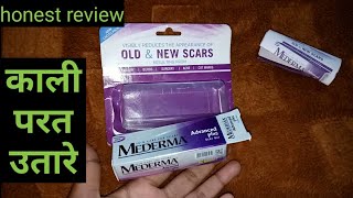 MEDERMA advanced scar gel Review in hindi  honest review by be alert product reviews [upl. by Cheke]