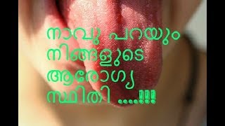 നാവ് പറയും നിങ്ങളുടെ ആരോഗ്യംNavile punnu navu vedana maran  tongue pain [upl. by Arata]