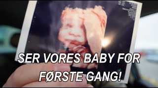 SER VORES BABY FOR FØRSTE GANG [upl. by Akeimat]