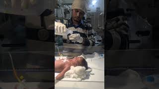 cleaning the stomach of a newborn baby youtubeshorts nursing newbornbaby stomach cleaning [upl. by Bigg]