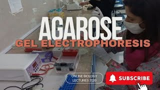 Agarose gel electrophoresis [upl. by Prospero]