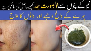 Neem face pack for acne and pimples  Instantly remove dryness from skin  Neem Face pack for winter [upl. by Sarita368]