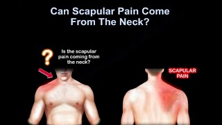 Neck pain or shoulder pain WHY IT HURTS [upl. by Danice963]