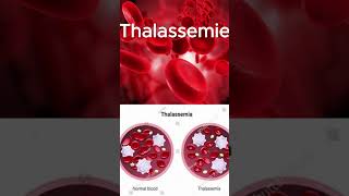 THALASSEMIE [upl. by Poll]