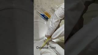 Oxidase test [upl. by Anos]