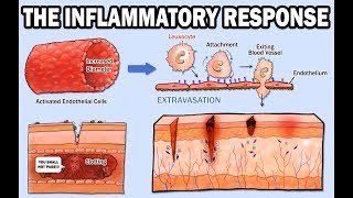 THE INFLAMMATORY RESPONSE [upl. by Berman949]