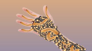 ASMR Animation Treatment Infected Removing Cytes larvae and worms from Infected Hand ASMRPOOJ1 [upl. by Alihs850]