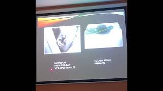 ecografia renal en pediatria dra tarde [upl. by Lippold]