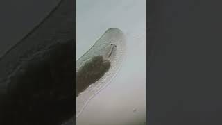 Flatworm Platyhelminthes under the microscope microscopy microscope science biology [upl. by Acinoj136]