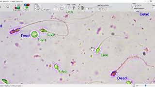 MMC Sperm sperm vitality analysis [upl. by Mroz]