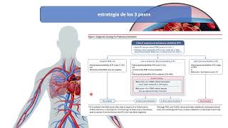 Tromboembolia pulmonar Diagnóstico tratamiento Alex Pintos [upl. by Mad918]