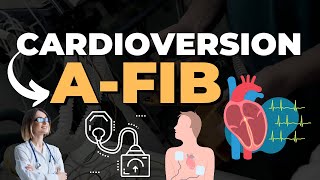 Cardioversion Procedure Steps and Video  E Healthy Info cardioversion [upl. by Htrow]