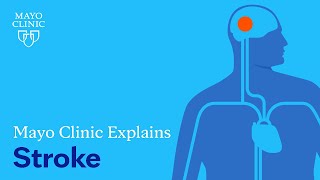 Mayo Clinic Explains Strokes [upl. by Tiffani]