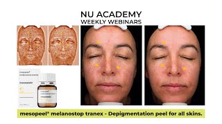 mesopeel® melanostop tranex Depigmentation peel for all skins [upl. by Viviyan]