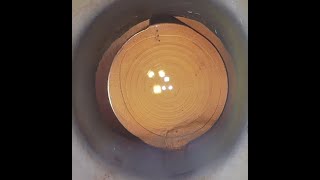 Cataract surgery with multifocal IOL implant [upl. by Aikym]