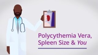 Polycythemia Vera Spleen Size amp You [upl. by Ytima599]