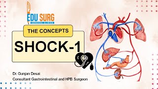 Understanding Shock l Pathophysiology of shock l Blalock classification l Types of shock [upl. by Ahsatsan]