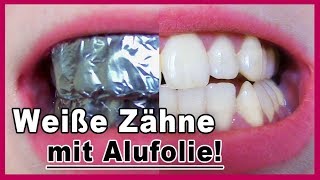 ▶︎ Zähne aufhellen mit Alufolie  es funktioniert [upl. by Stafani]