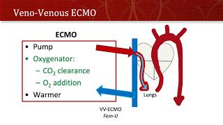 Thinking Simple  ECMO [upl. by Perrins297]