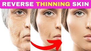 Top 5 Natural Remedies to THICKEN THIN SKIN [upl. by Beulah]