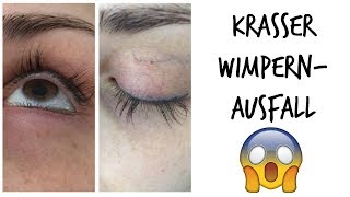 REVITALASH REVIEW  WIMPERNAUSFALL  NEBENWIRKUNGEN  KathisFinest [upl. by Peppy]